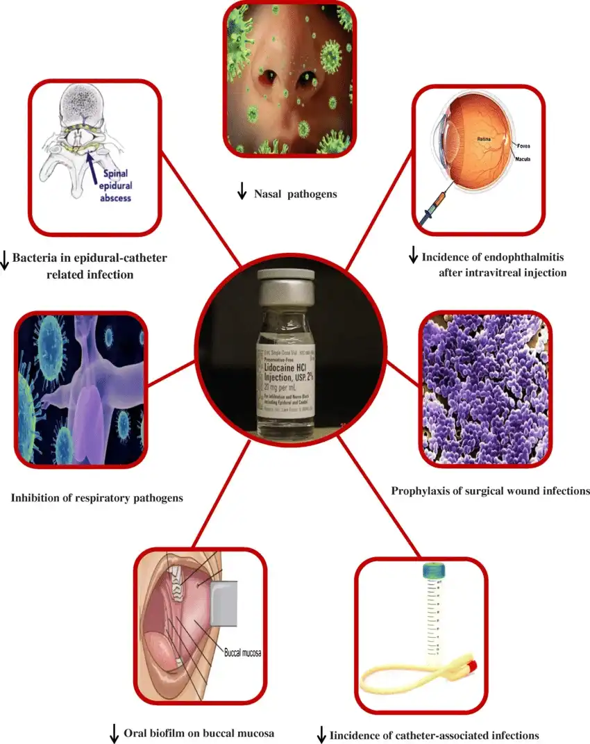 The-antimicrobial-application-of-lidocaine.webp